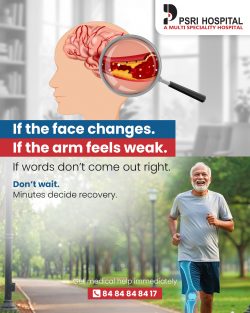 Act FAST: Every Second Counts
