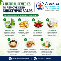 7 Natural Remedies to Remove Deep Chickenpox Scars