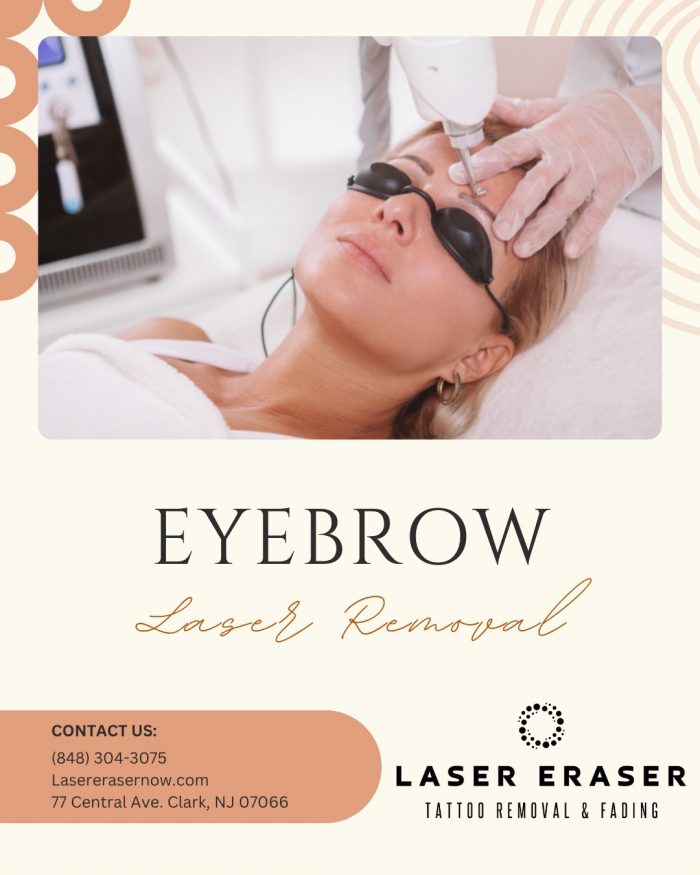 Safe And Effective Eyebrow Laser Removal Treatment