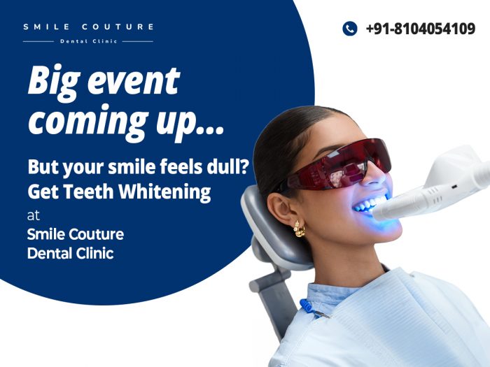 Big Event Coming Up? Transform Your Smile with Teeth Whitening in Andheri West
