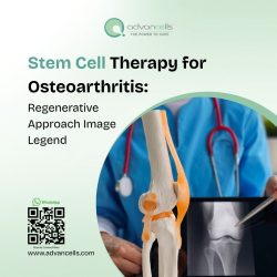 Stem Cell Therapy for Osteoarthritis: Regenerative Approach Image Legend