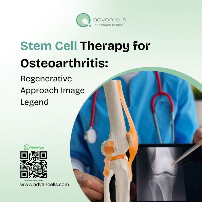 Stem Cell Therapy for Osteoarthritis: Regenerative Approach Image Legend