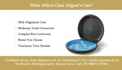 Clear Aligners Cost in Coimbatore – What Matters Most?