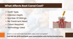 What Affects Root Canal Cost?