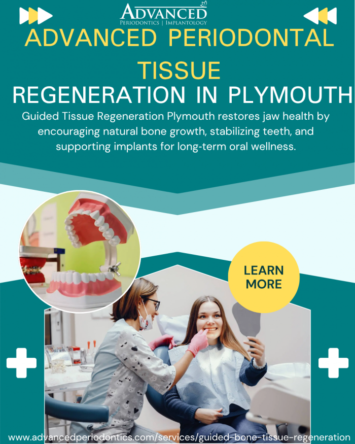 Strengthen Your Jaw with Guided Bone Regeneration Therapy
