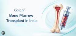 Affordable Bone Marrow Transplant Cost in India for International Patients