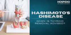 Affordable Cost of Thyroidectomy for Hashimoto’s Disease in India | HOSPIDIO