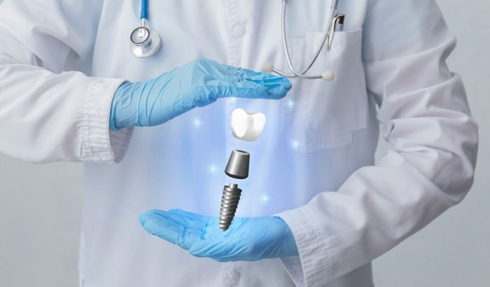 Why Choosing the Best Implant Dentist in Abu Dhabi Matters for Your Smile