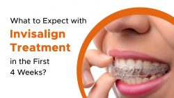What to Expect During Your First 4 Weeks of Invisalign Treatment