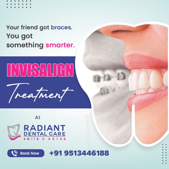 Clear Aligners, Clear Confidence