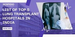 Top 5 Hospitals for Lung Transplant in India for International Patients | HOSPIDIO