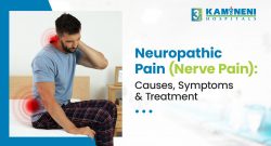 Understanding Neuropathic Pain Causes, Symptoms & Effective Treatment