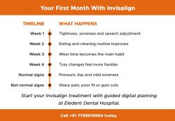Your First Month with Invisalign What to Expect Week by Week