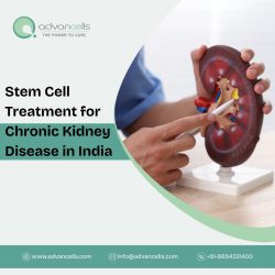 Stem Cell Treatment for Chronic Kidney Disease in India