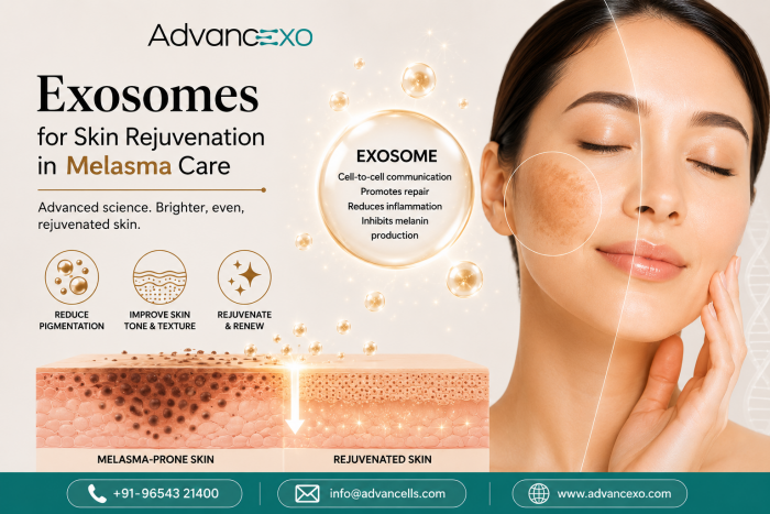 Exosomes for Skin Rejuvenation in Melasma Care