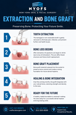 Expert Impacted Canine Extraction for Healthy Smile Alignment