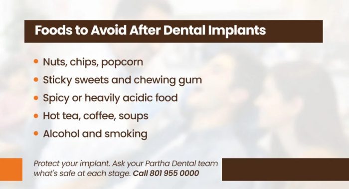 Foods to Avoid After Dental Implants for Faster Healing