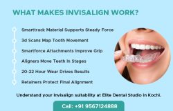 The Key Factors Behind Successful Invisalign Results