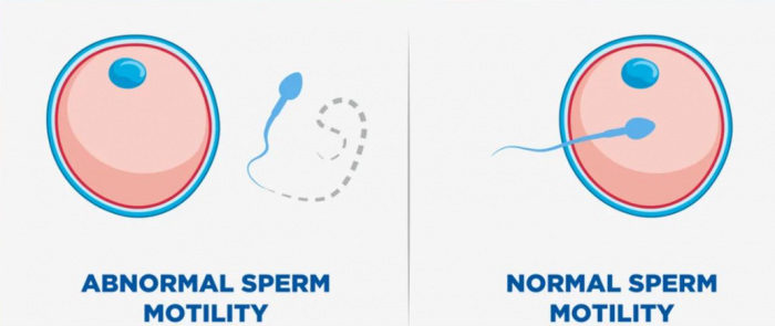Clia Sperm Test Delaware