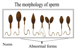 Seminal fluid analysis Austin TX