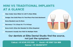 Mini vs Traditional Dental Implants: Which Is Right for You?