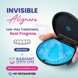 Invisible Aligners for a Confident Smile