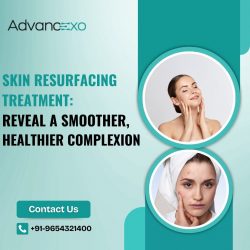 Skin Resurfacing Treatment: Reveal a Smoother, Healthier Complexion
