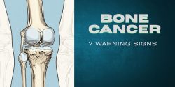 7 Bone Cancer Symptoms Everyone Should Know Before It’s Too Late | HOSPIDIO