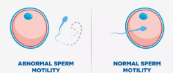 Clia sperm test austin texas