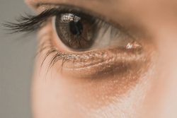Dark Circle Treatment in Delhi: Restore Brighter and Refreshed Eyes