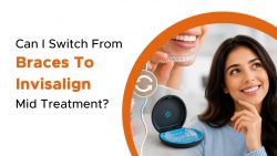 Can You Switch From Braces to Invisalign Mid-Treatment?
