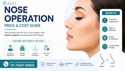 Nose Operation Price – Affordable Rhinoplasty Cost Guide