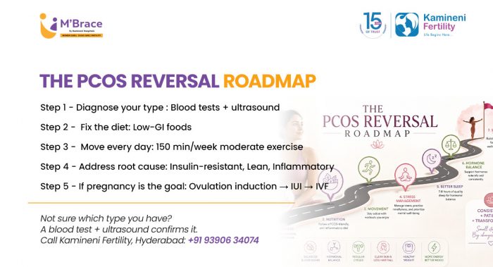 PCOS Reversal Roadmap: 5 Steps to Better Health