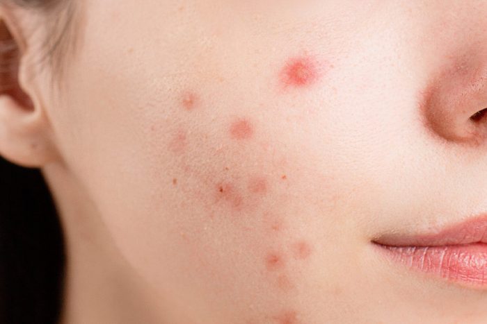 Best Dermatologist in South Delhi