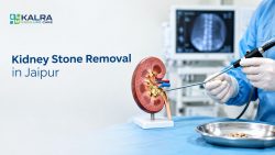 Kidney Stone Removal in Jaipur by Dr. Deepesh Kalra