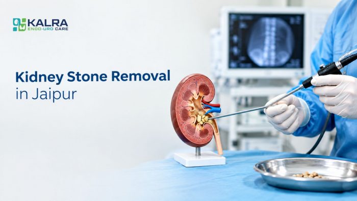 Kidney Stone Removal in Jaipur by Dr. Deepesh Kalra