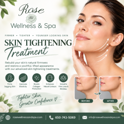 Skin Tightening Treatment – Restore Firmness & Achieve a Youthful Appearance