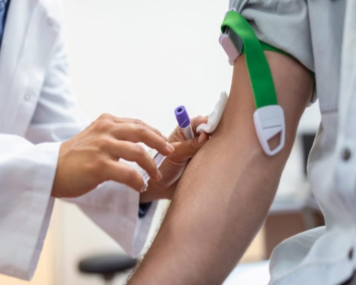 Advanced Spider Veins Treatment Dubai Services