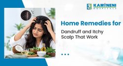 Home Remedies for Dandruff and Itchy Scalp That Work