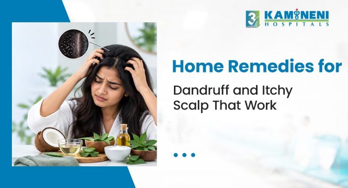 Home Remedies for Dandruff and Itchy Scalp That Work