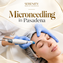 Microneedling in Pasadena for Improved Skin Texture and Glow