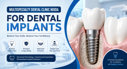 Multispecialty Dental Clinic Noida for Better Dental Implants