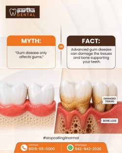 Think gum disease stops at your gums?