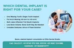 Which Dental Implant is Right for You?